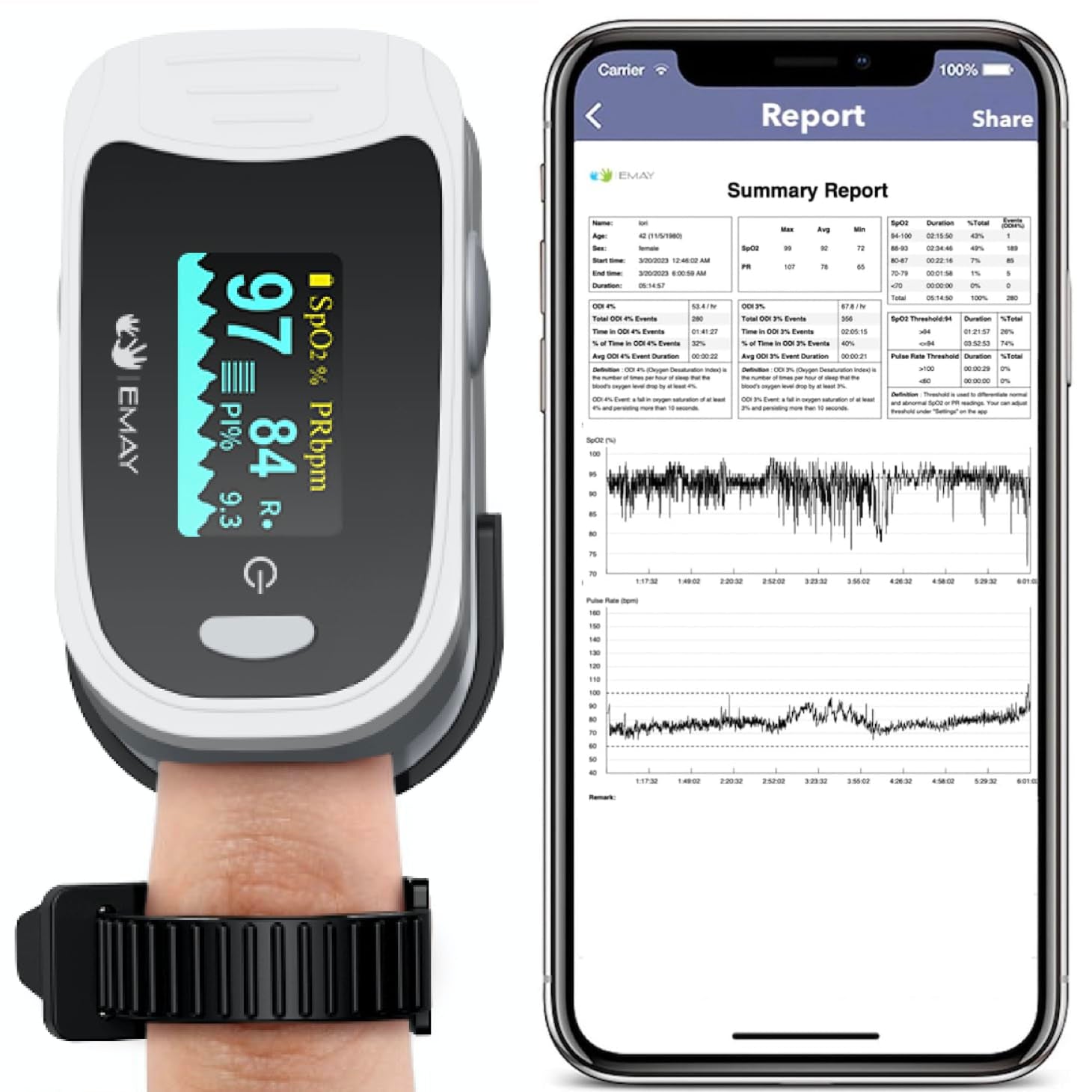 Sleep Oxygen Monitor with Built-In Recording Capability | Track Continuous Blood Oxygen Levels & Pulse Rate Overnight | Provides Sleep Report & Raw Data
